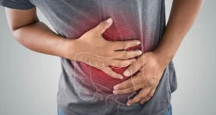 colon cancer