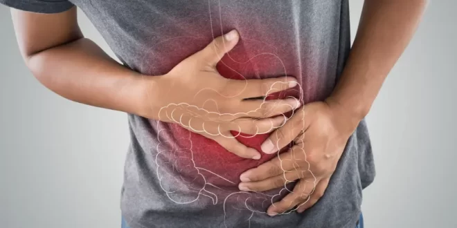 colon cancer
