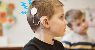 Speech and Hearing Therapy after Cochlear Implant Surgery