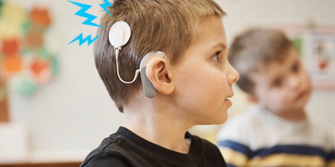 Speech and Hearing Therapy after Cochlear Implant Surgery
